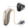 Prothèse auditive Audika360
