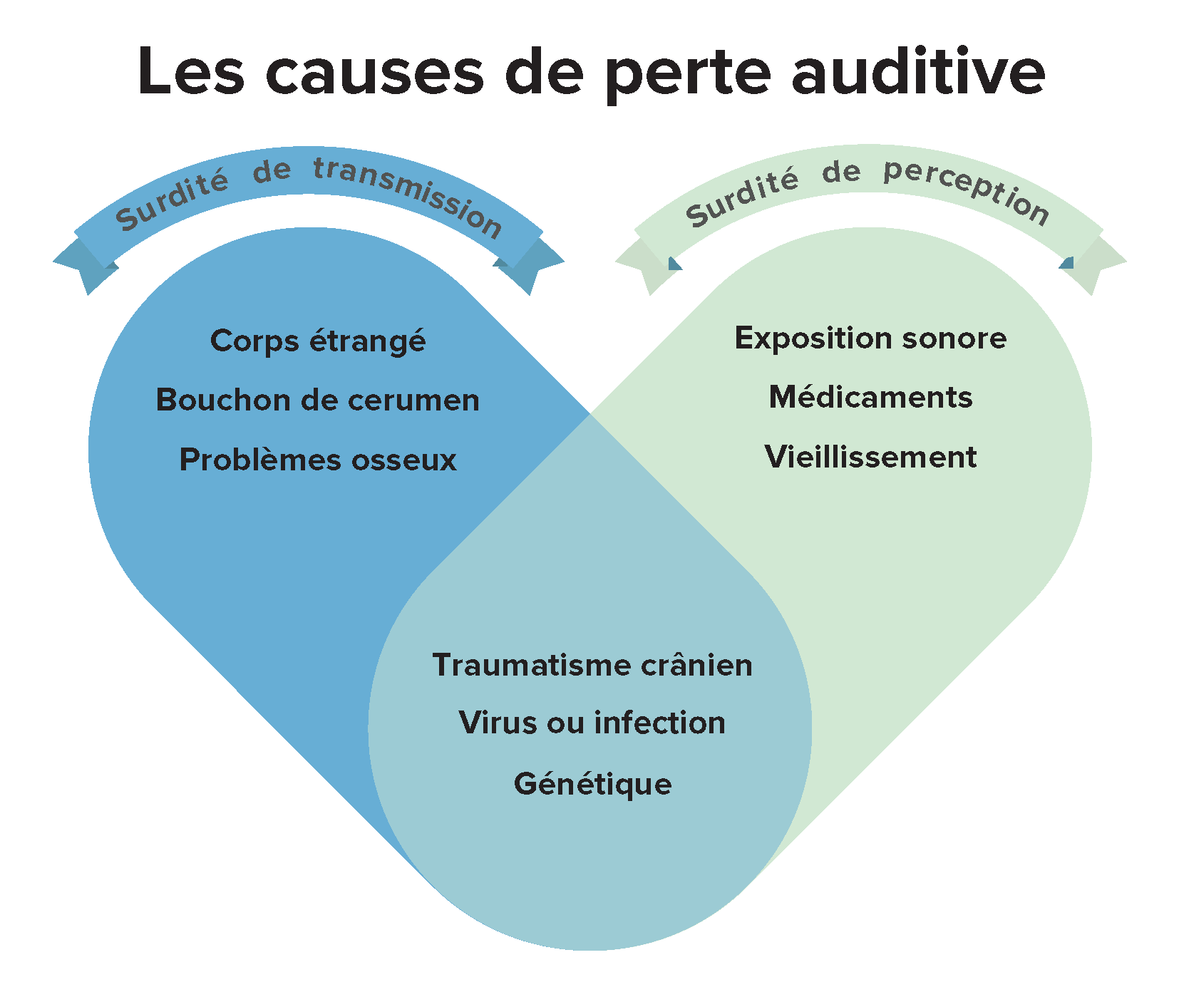 l’image montre un cœur divisé en différentes causes de perte auditive