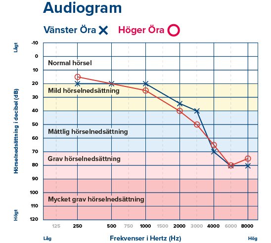 Bild på ett audiogram som visar resultatet av ett hörseltest