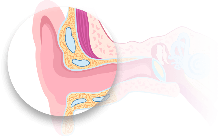Bild på ytterörat som förklarar hur örat fungerar och dess anatomi.