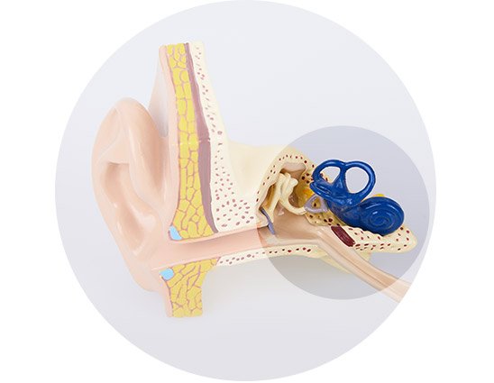 Bild på ett öra som visar bilateral sensorineural hörselnedsättning