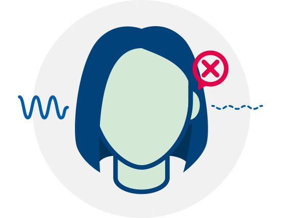 Bild på en illustration av en bild där det är ett kryss över ena örat för att visa vad unilateral hörselnedsättning är