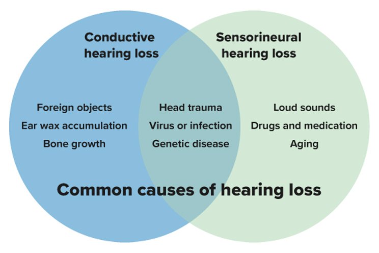 Diagram showing the common causes and types of hearing loss