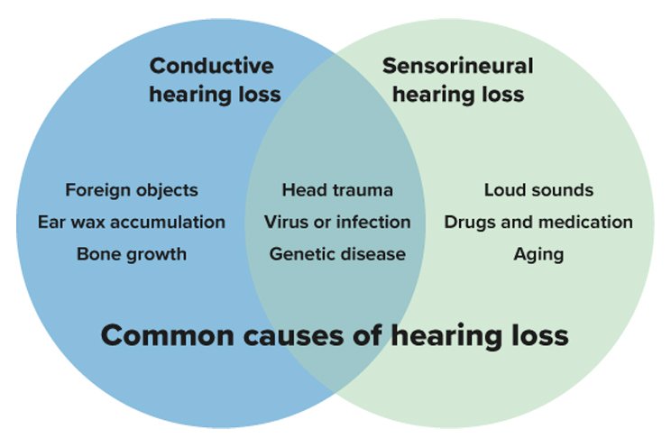 Types Of Hearing Loss Symptoms And Treatment