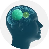 Illustrationen viser BrainHearing-teknologi
