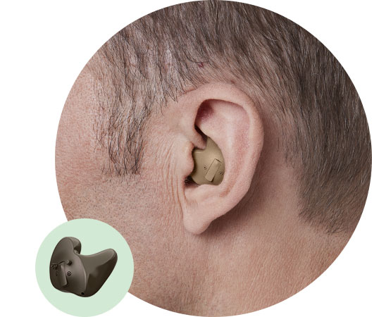 La imagen muestra un audífono intrauricular de concha completa en el oído