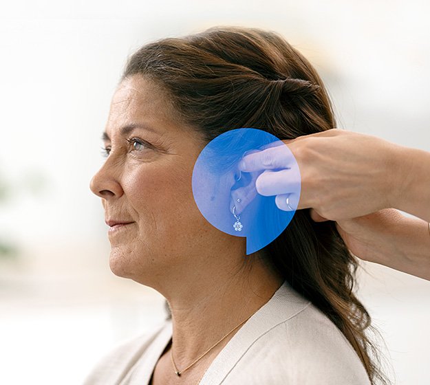 L’image montre une femme à qui l’on place un appareil auditif derrière l’oreille