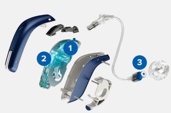 illustratie van onderdelen van hoorapparaten